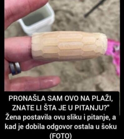 “PRONAŠLA SAM OVO NA PLAŽI, ZNATE LI ŠTA JE U PITANJU?” Žena Postavila Ovu Sliku I Pitanje, A Kad Je Dobila Odgovor Ostala U Šoku (FOTO)