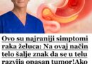 Ovo su najraniji simptomi raka želuca